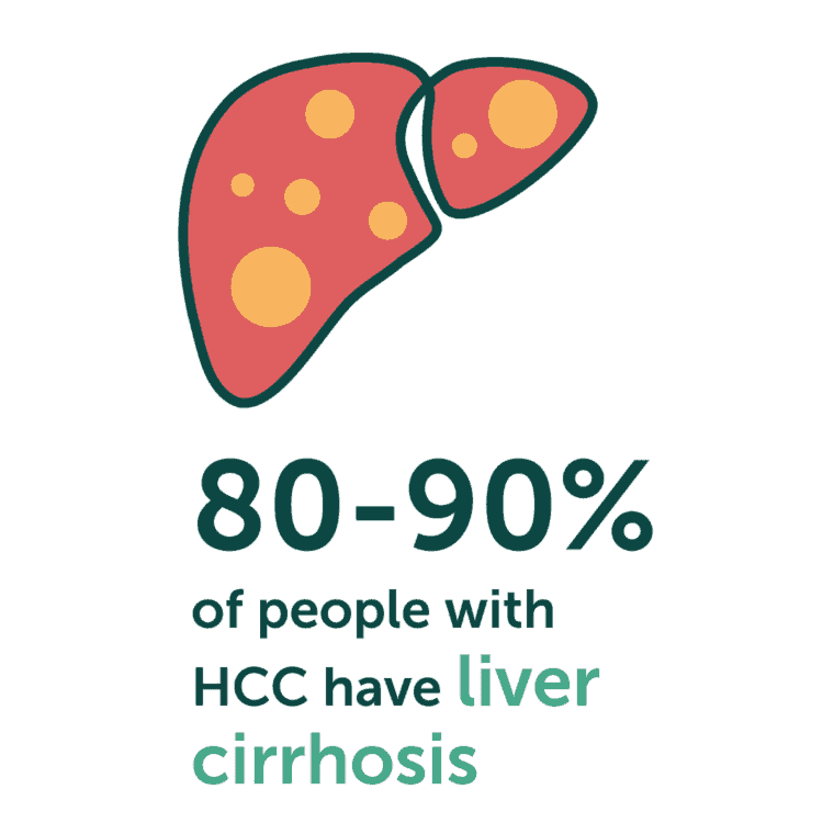 80 to 90% of people with HCC have cirrhosis