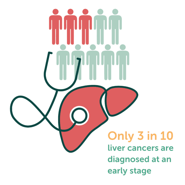 Only 3 in 10 liver cancer are diagnosed at an early stage