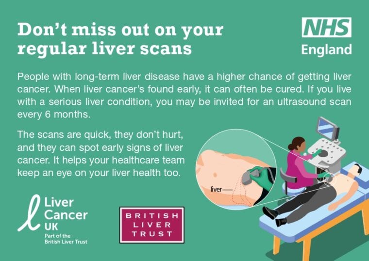 Healthcare Resources For Liver Cancer Awareness Month Liver Cancer Uk 9884